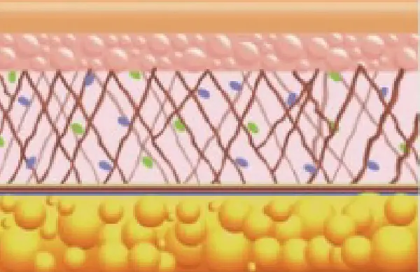組織膠 組織膠皮瓣
