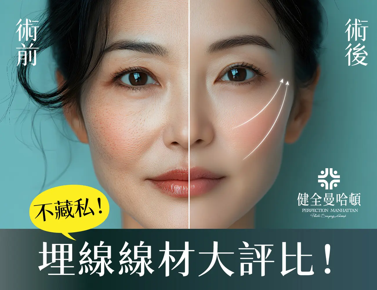 埋線線材 1300x1000