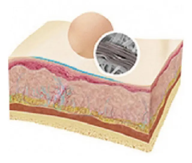 埋線線材 六個月後