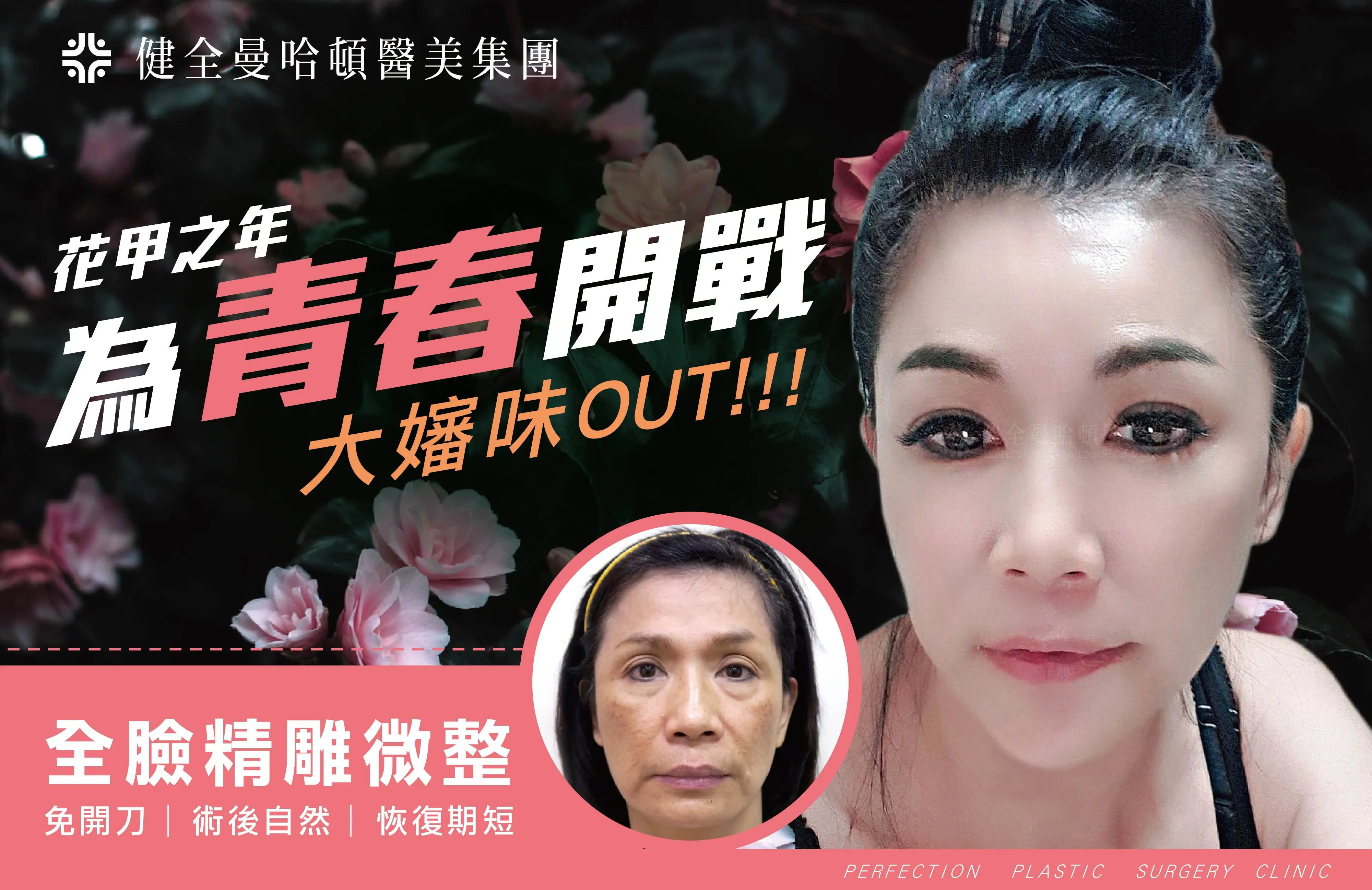 林小姐