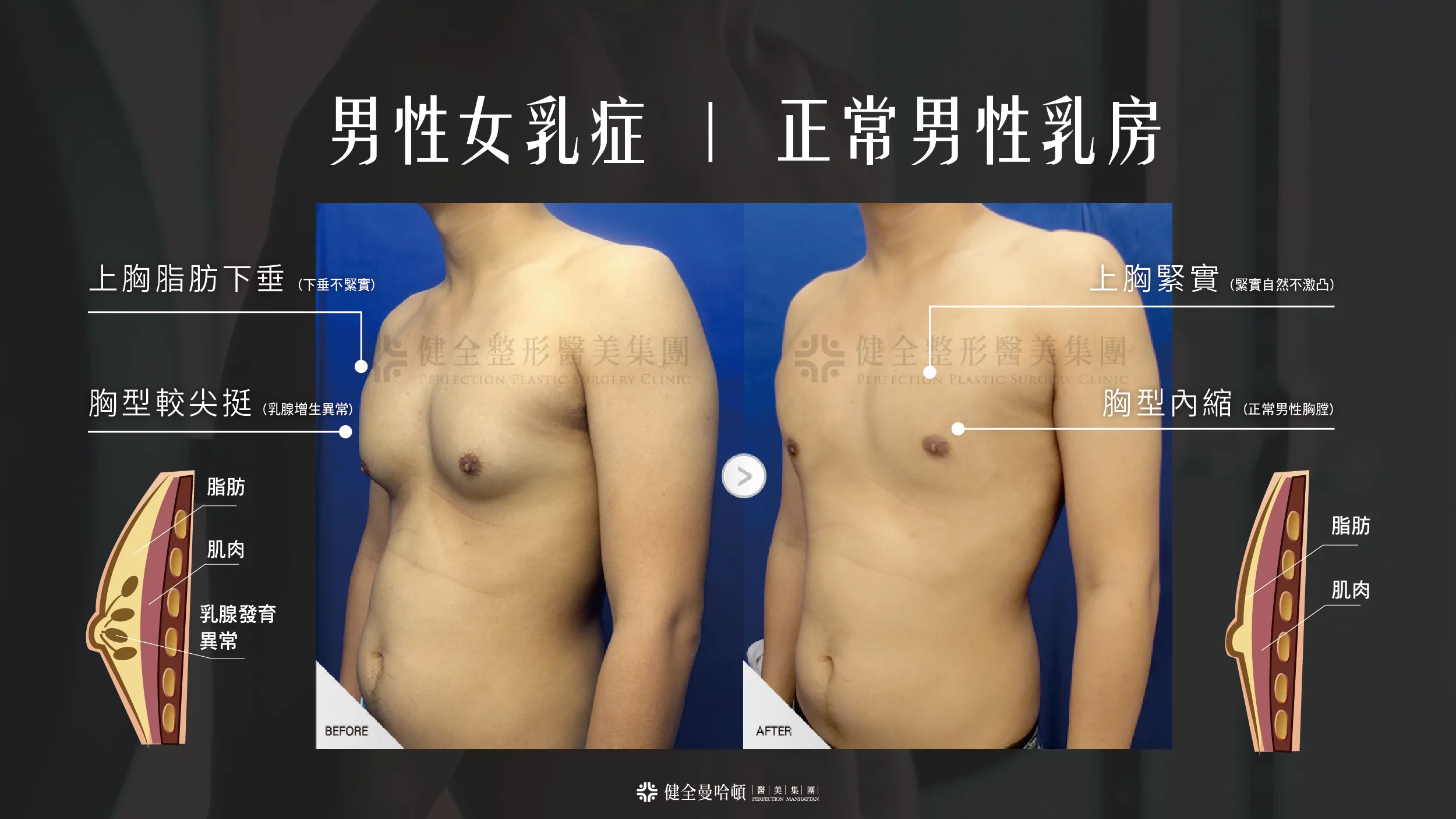 男乳 02