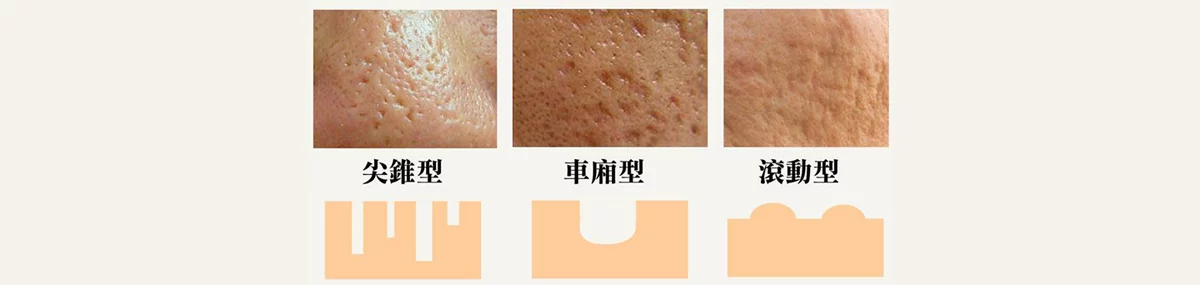 2658471a041048258cda4e1e6254274c