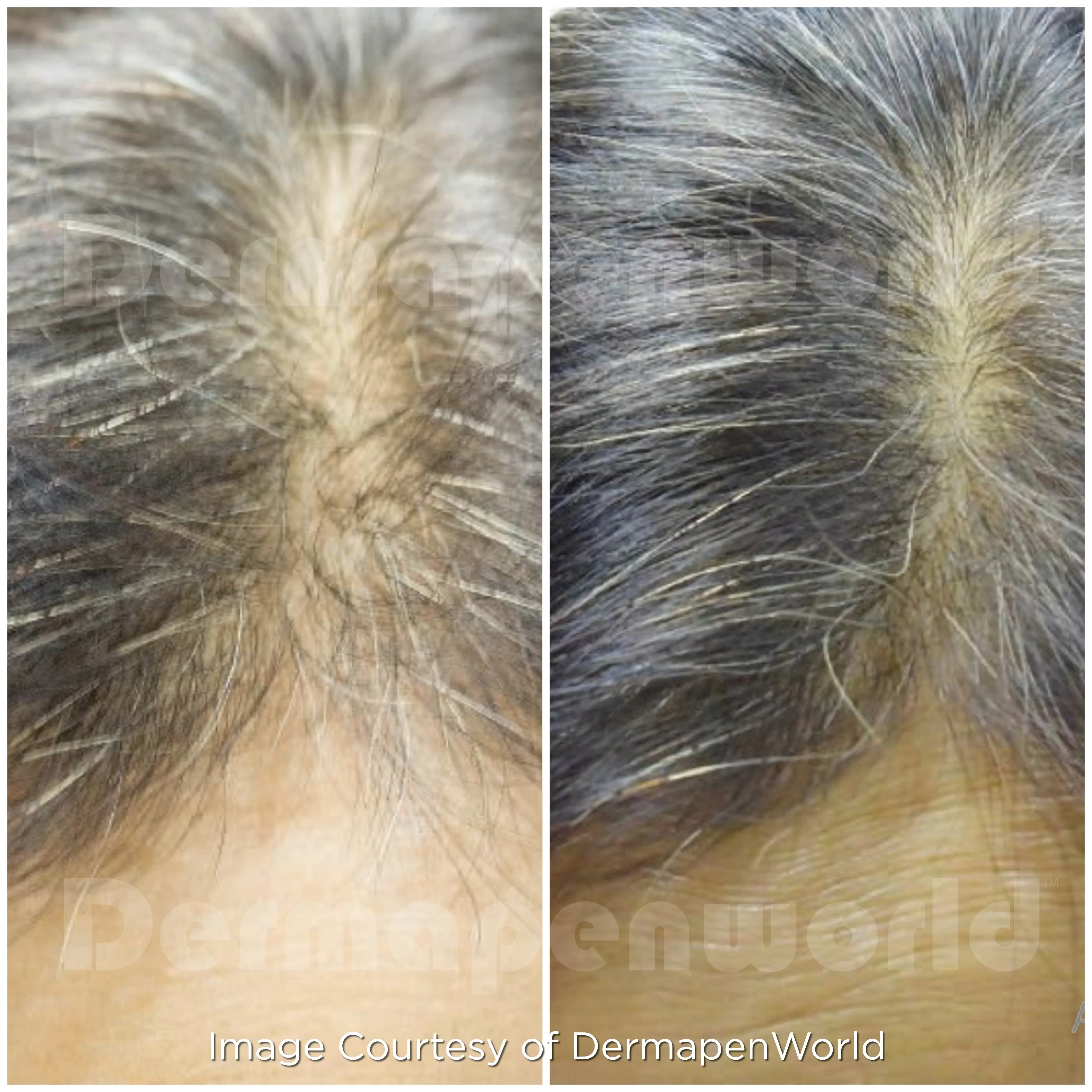 EXO Client 113 Hair Female