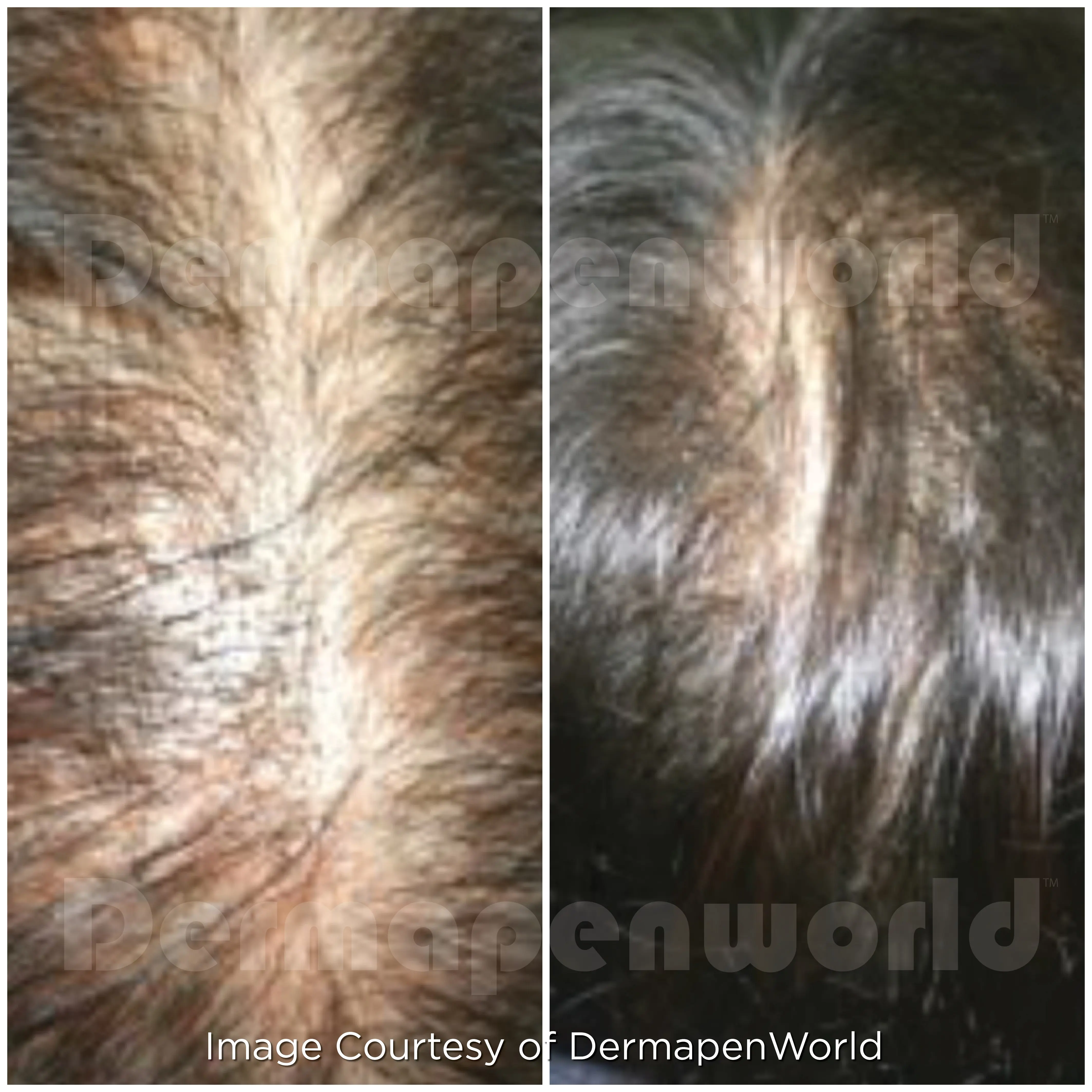 EXO Client 125 Hair Female