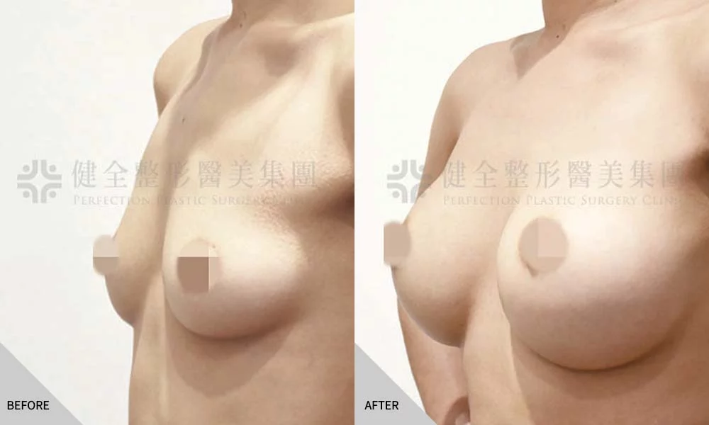 哺乳萎縮 01