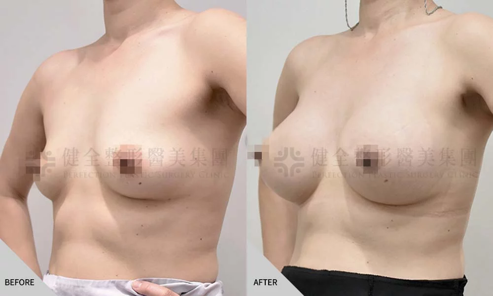 哺乳萎縮 02
