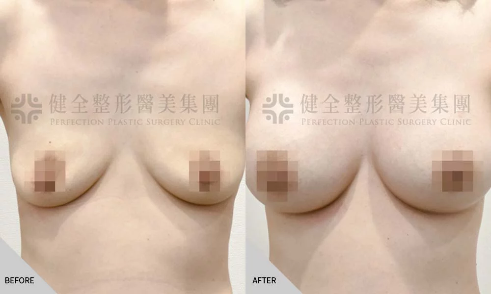 哺乳萎縮 07