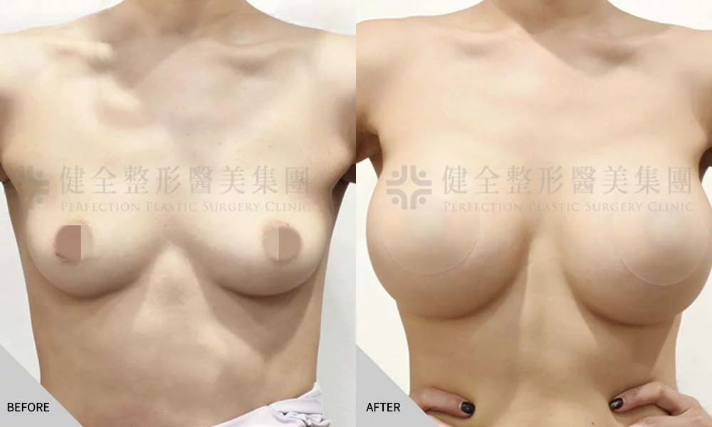 哺乳萎縮 08