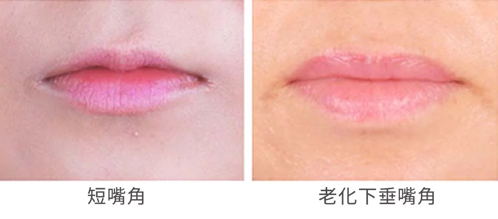 嘴角上揚 03 3