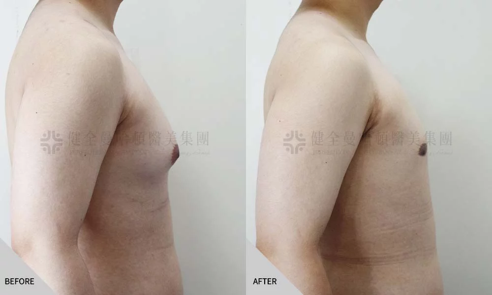 張奕鴻 男乳 03