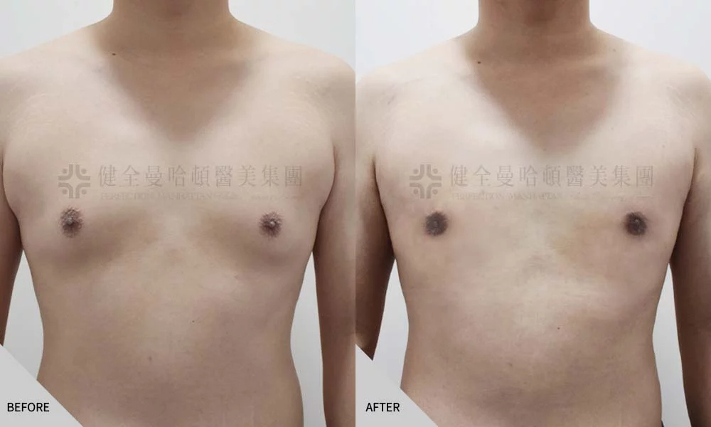 張書銘 男乳 01