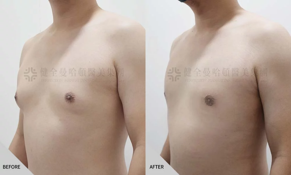 張書銘 男乳 02