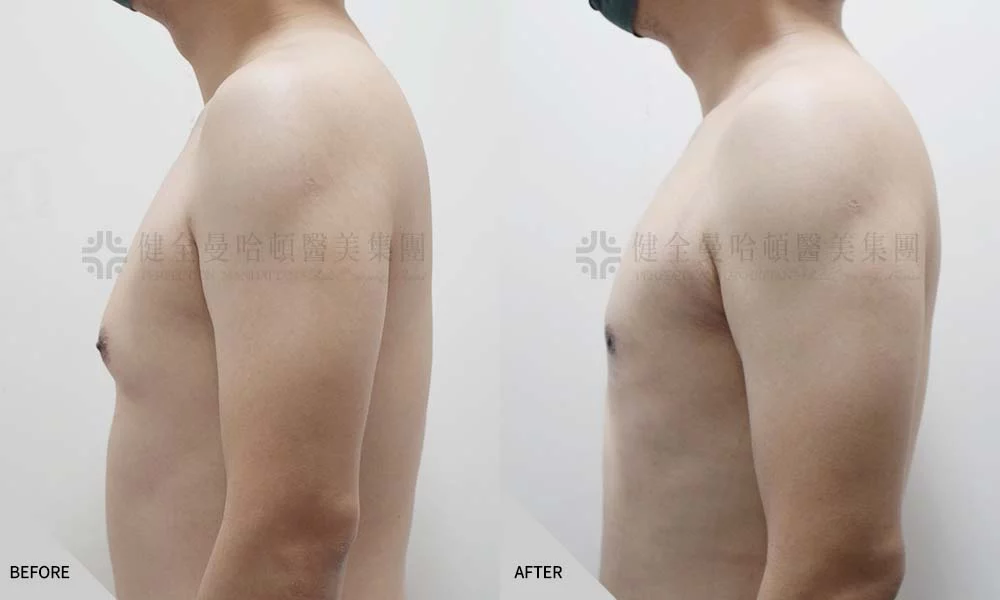 張書銘 男乳 03