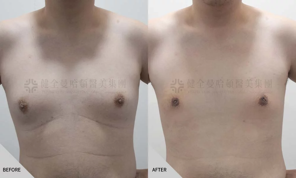 李中仁 男乳 01
