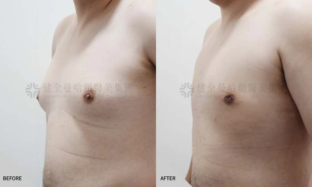 李中仁 男乳 02
