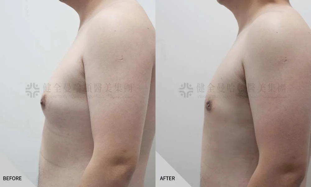 李中仁 男乳 03