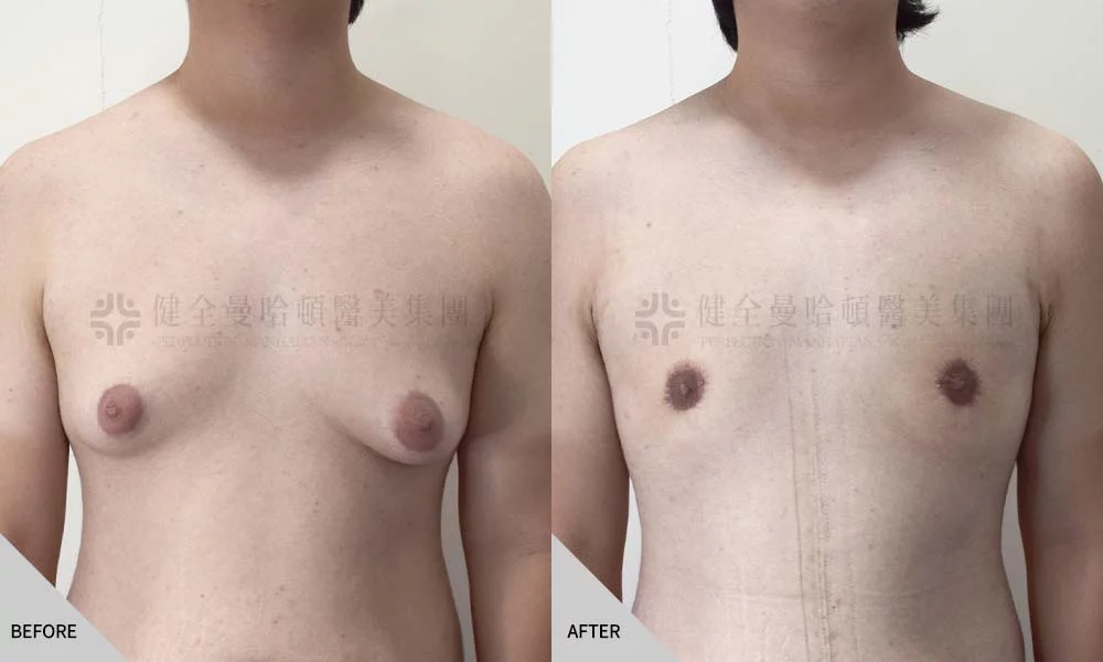 連浚翔 男乳 01
