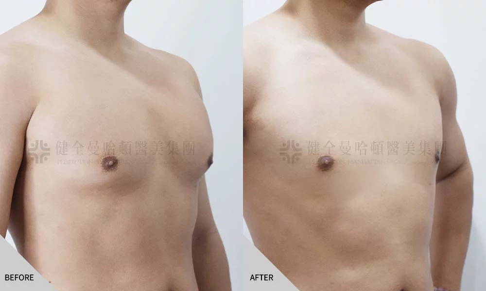 陳柄沅 男乳 04
