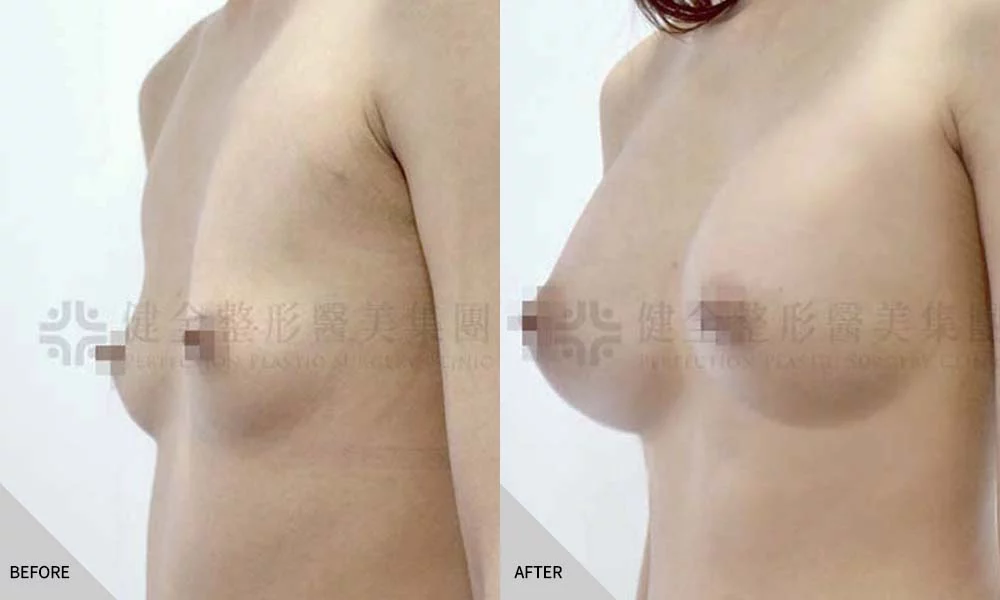 體型偏瘦 17