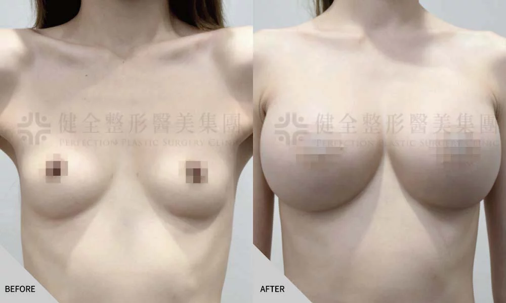 體型偏瘦 26