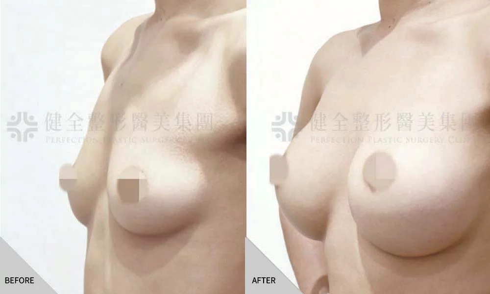 體型偏瘦 27