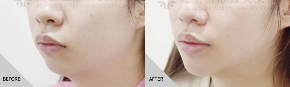 3d584455565fc75f
