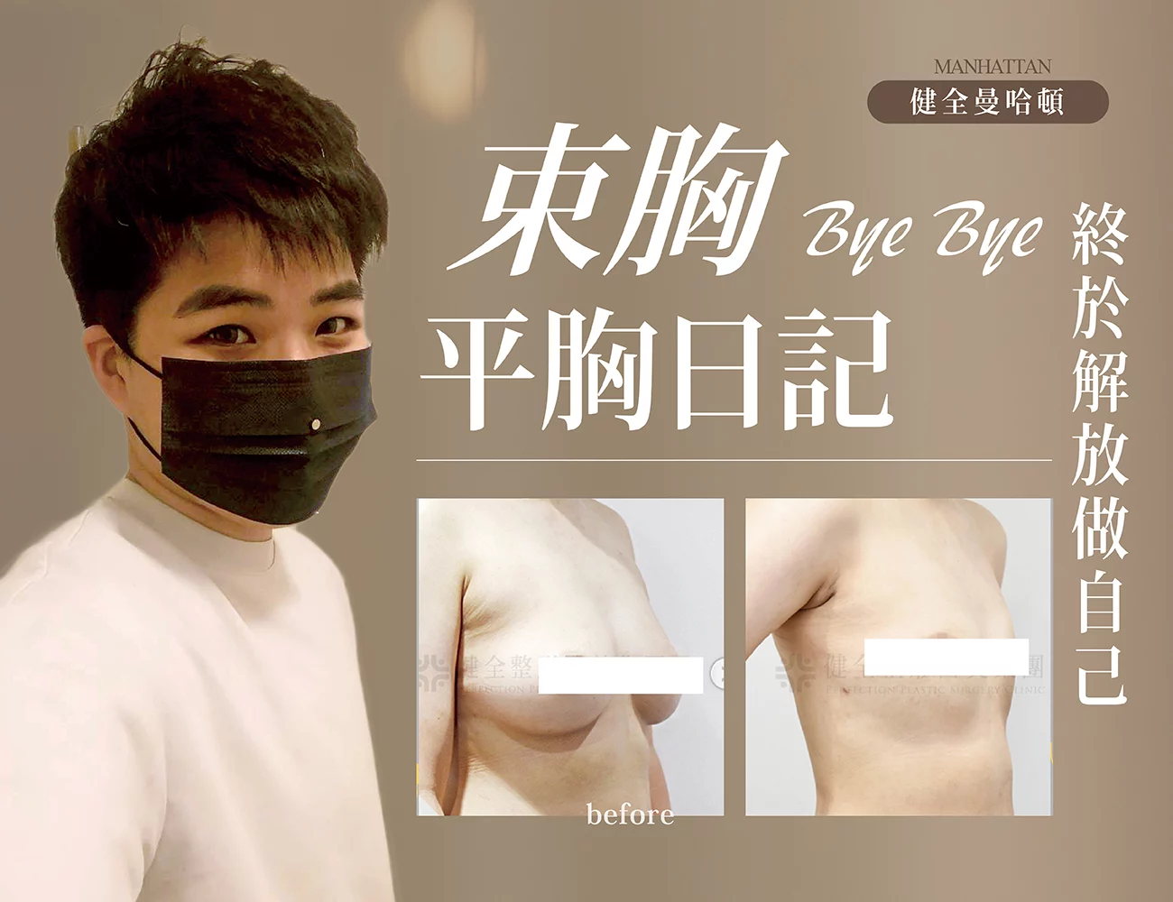 【平胸】阿B