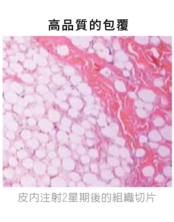 洢蓮絲 PCL 3