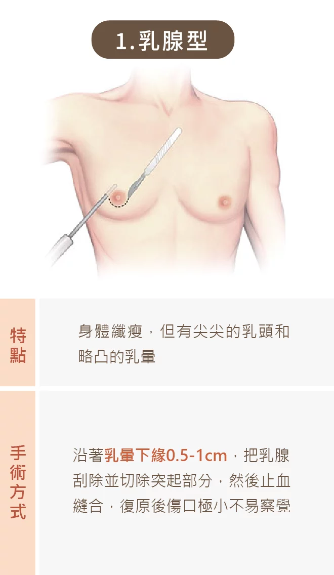 男性女乳 01 
