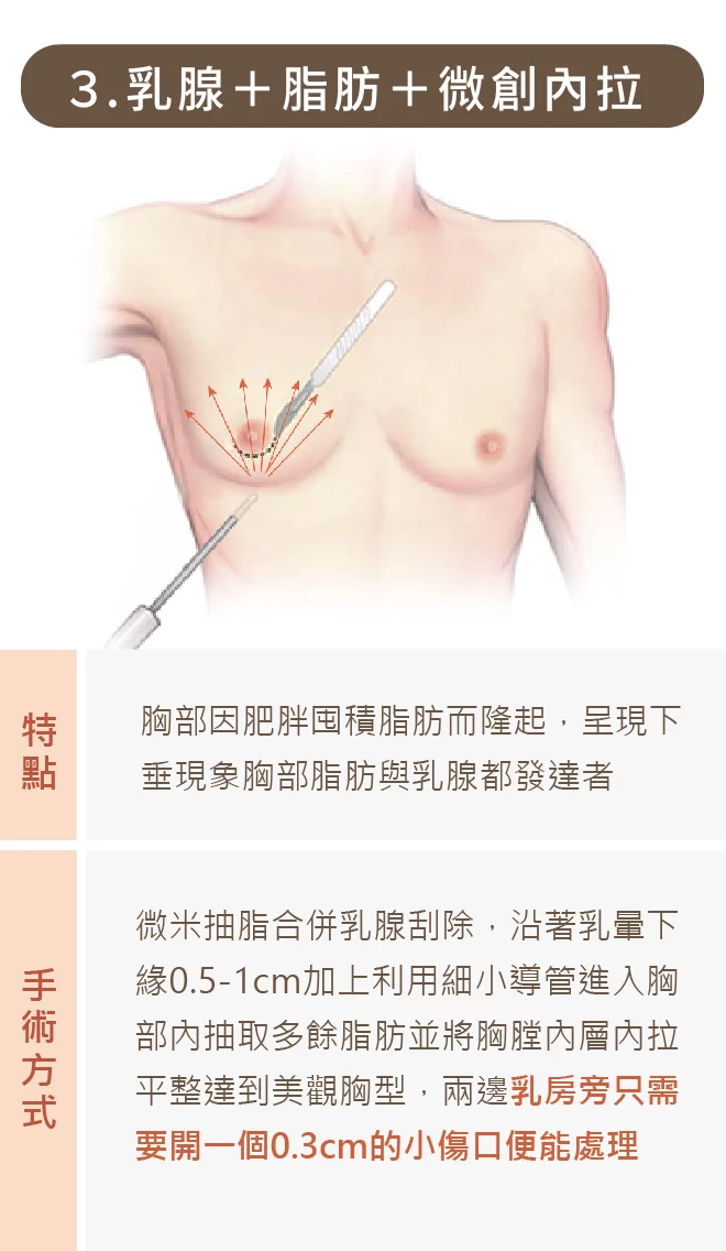 男性女乳 04 