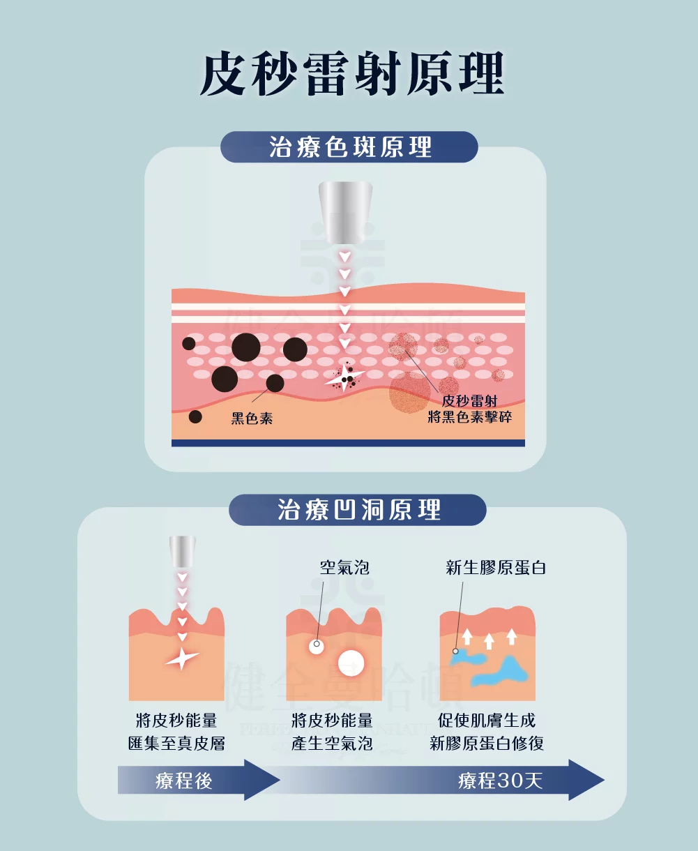 皮秒 效果圖 1