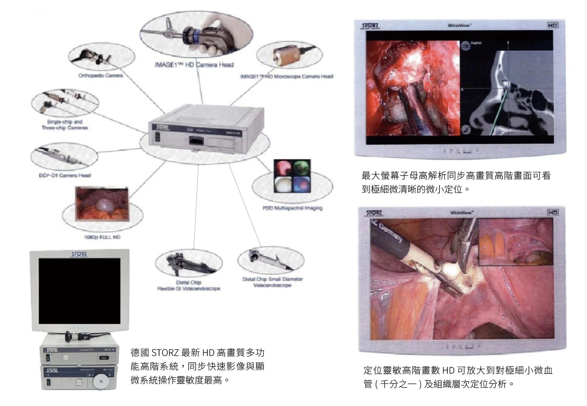 臉部拉皮手術 內視鏡器材