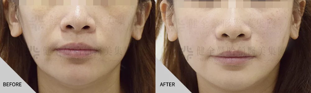 舒顏萃案例 05