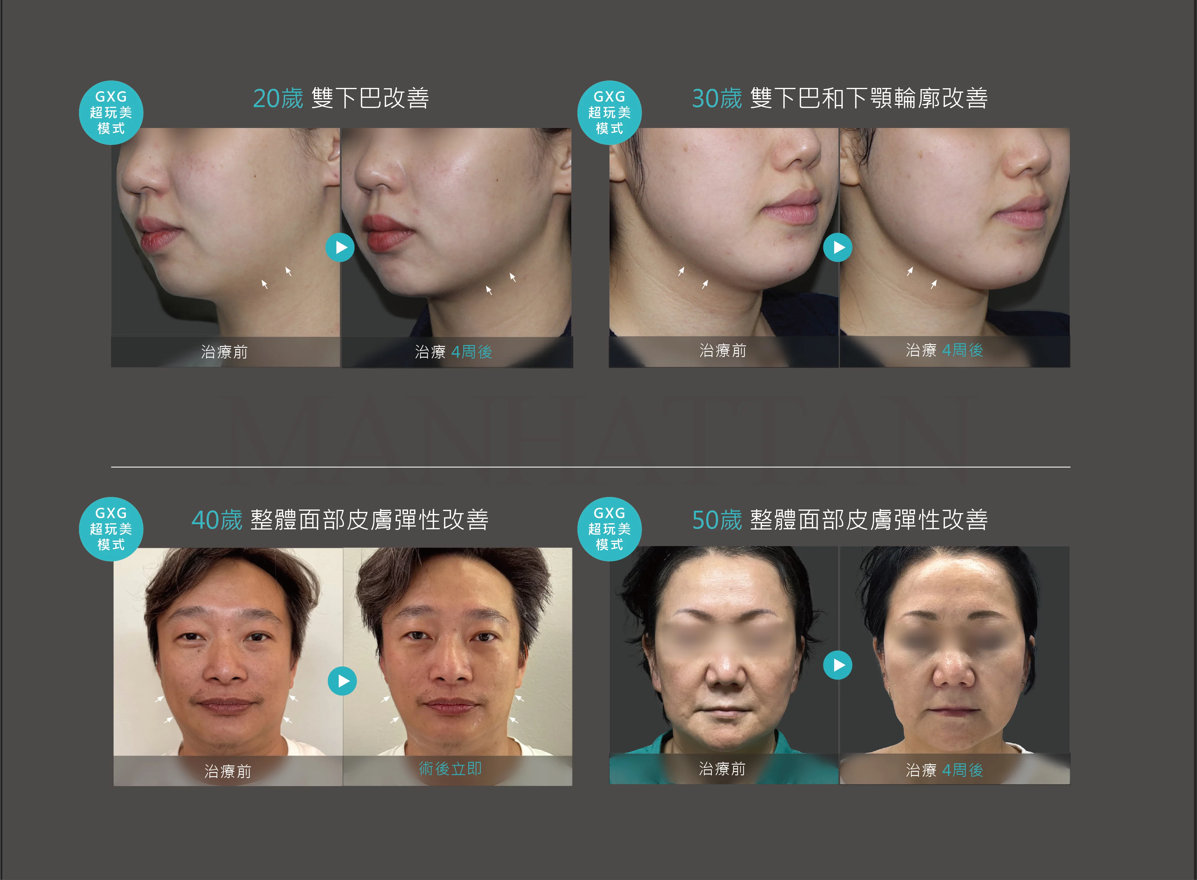 超玩美 13