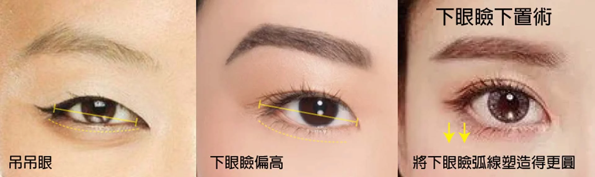 開眼頭眼尾 05