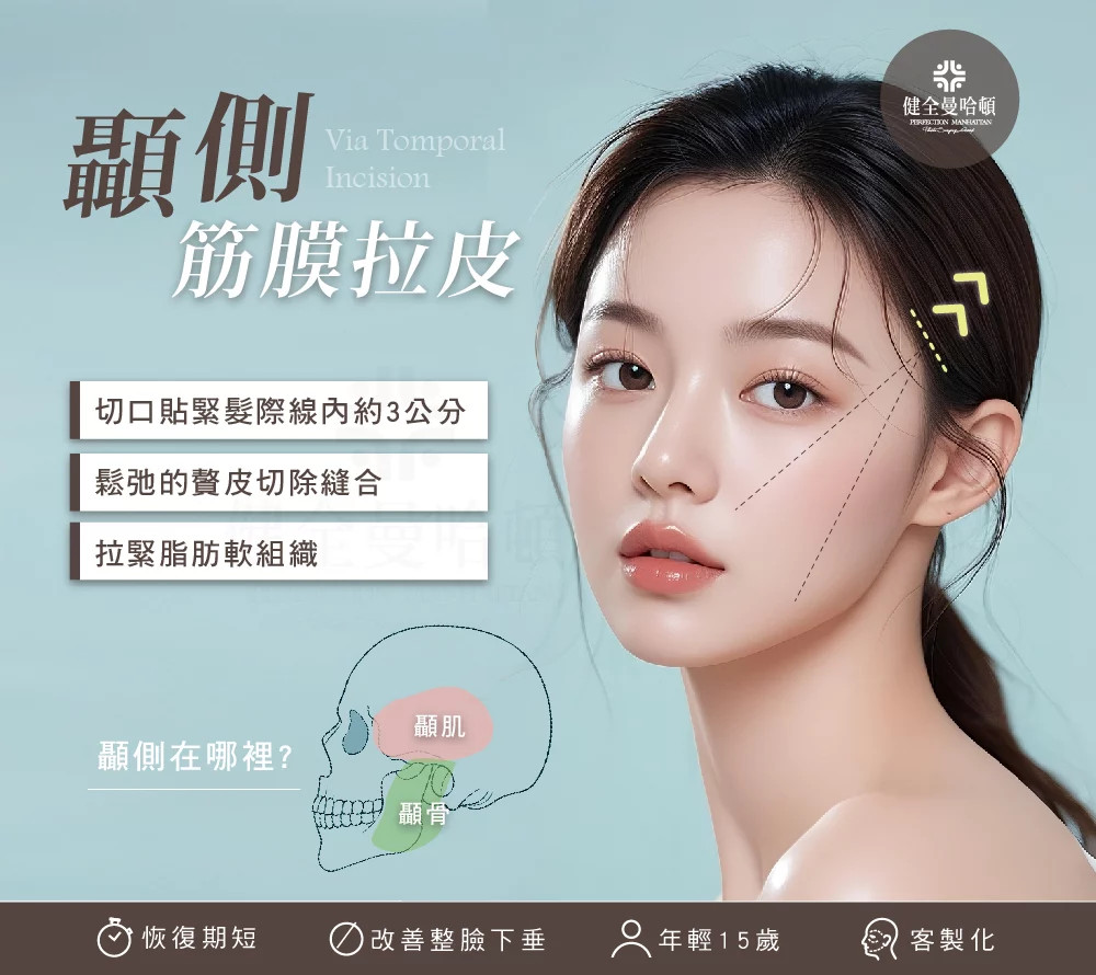 顳側拉皮 位置