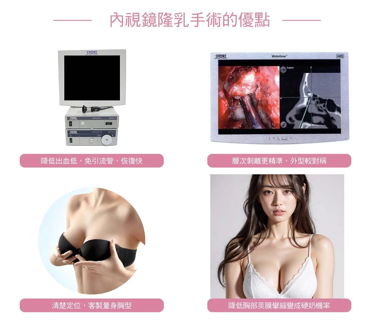 內視鏡隆乳 