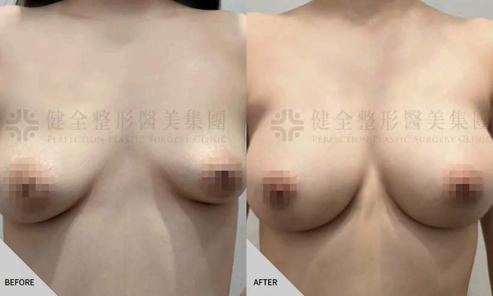 大小不對稱 02