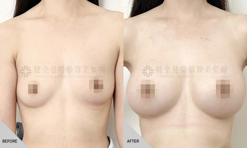 女王波 王雅亭 01