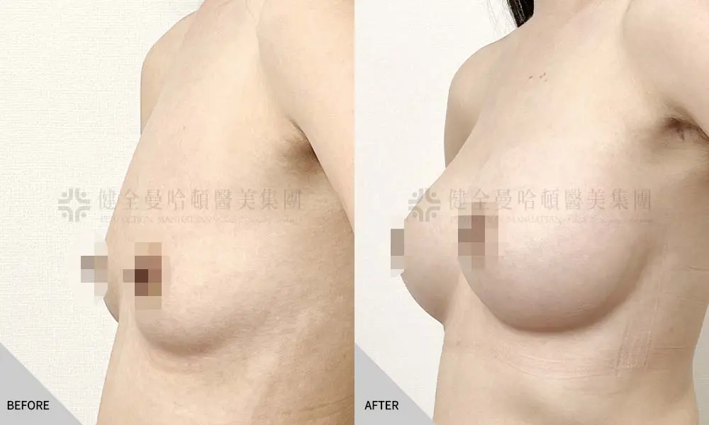 女王波 王雅亭 02