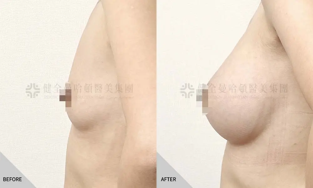 女王波 王雅亭 03