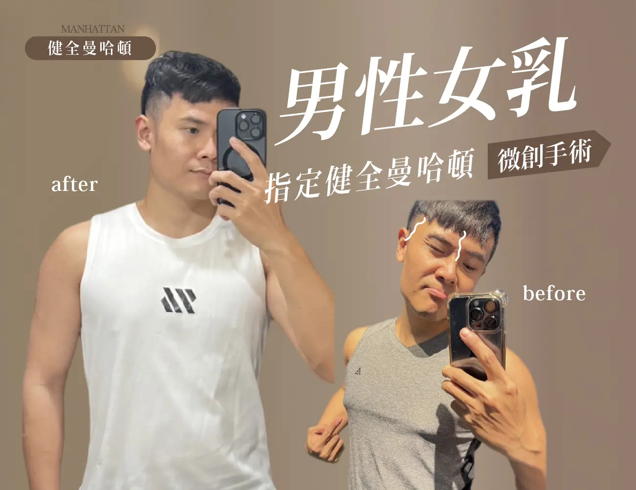陳柄沅 男乳