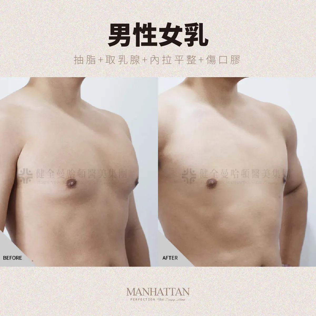 陳柄沅 男乳 02 複本 2