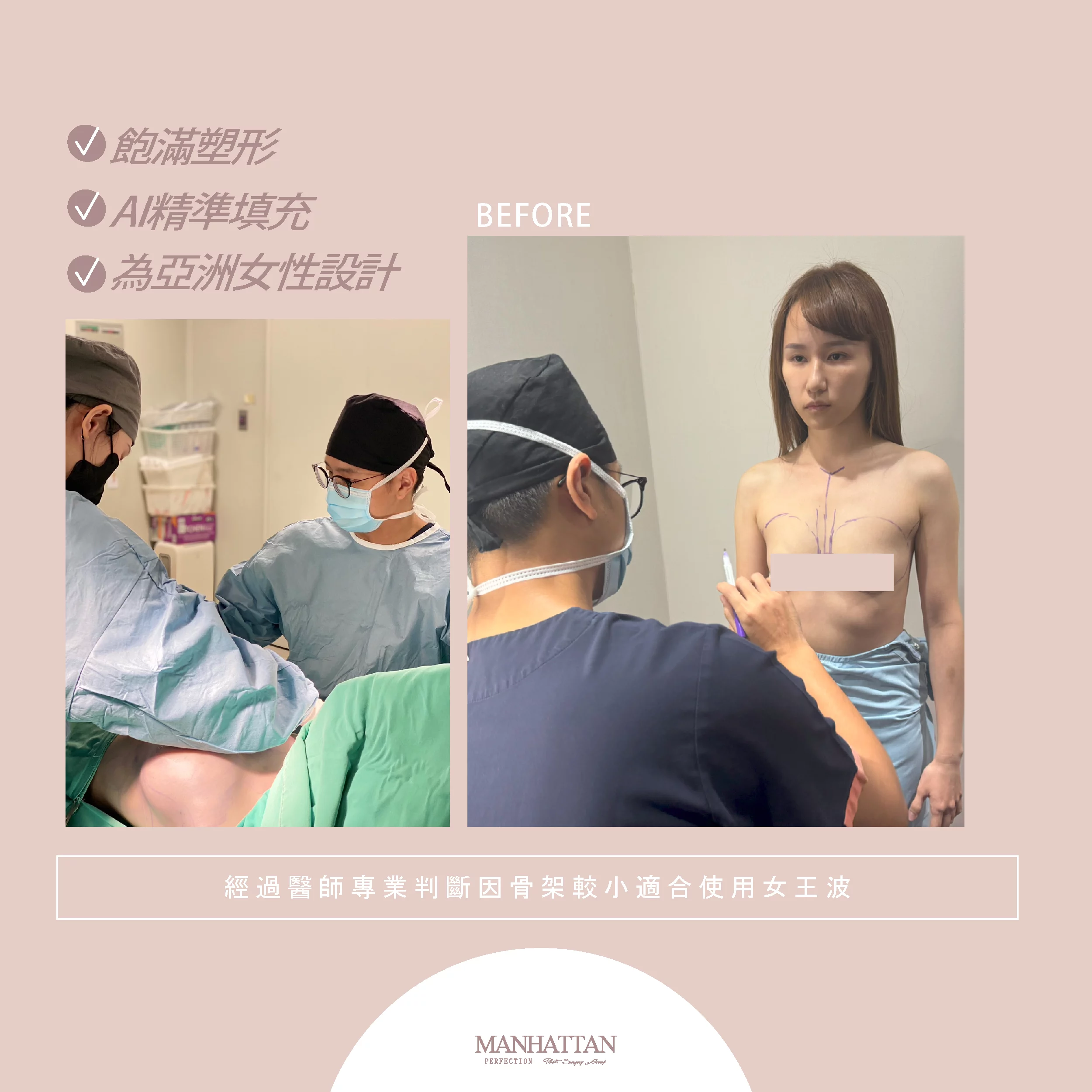 隆乳 郭惠瑜 03
