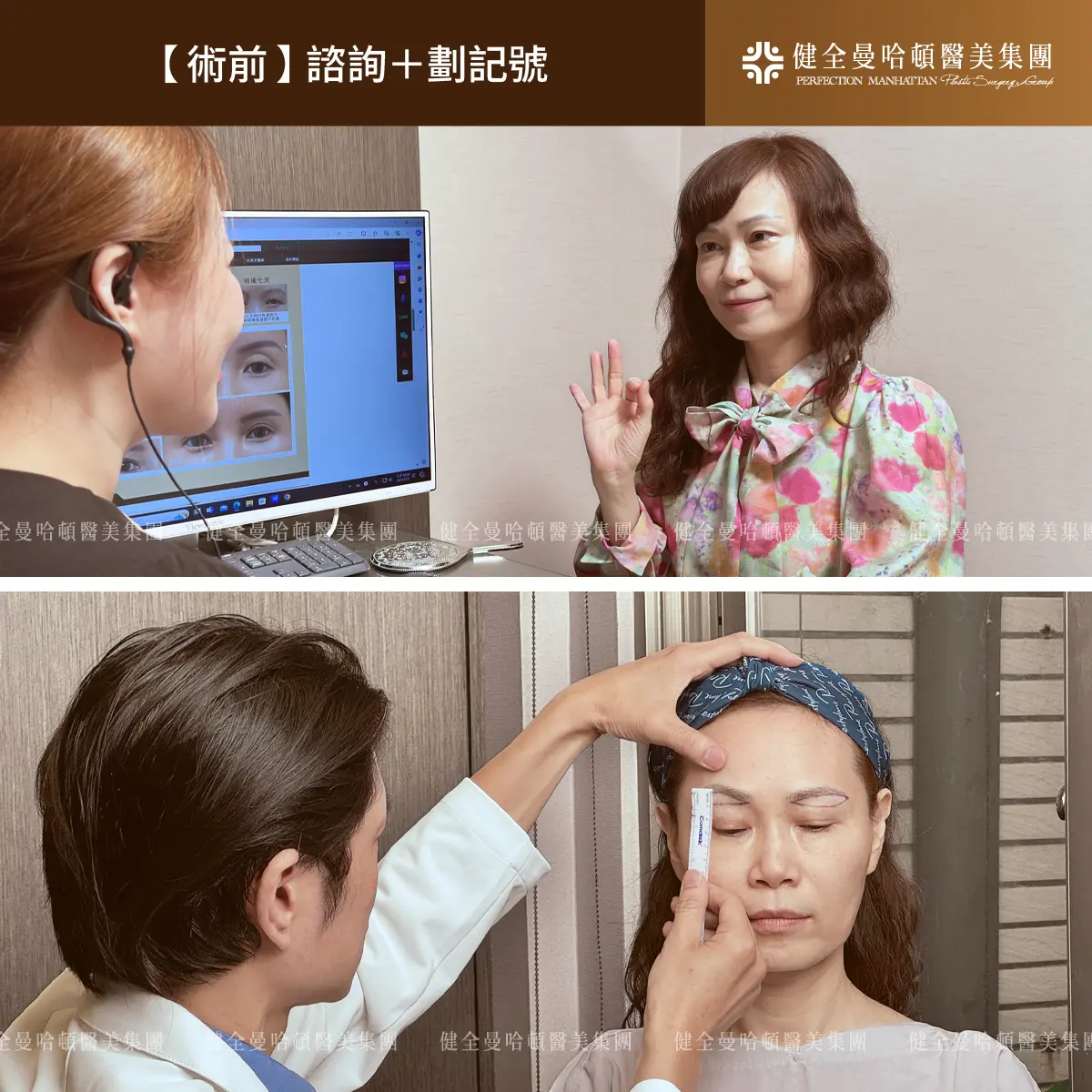 BA 劉恬良 眉下切X改善眼瞼下垂 1007 01