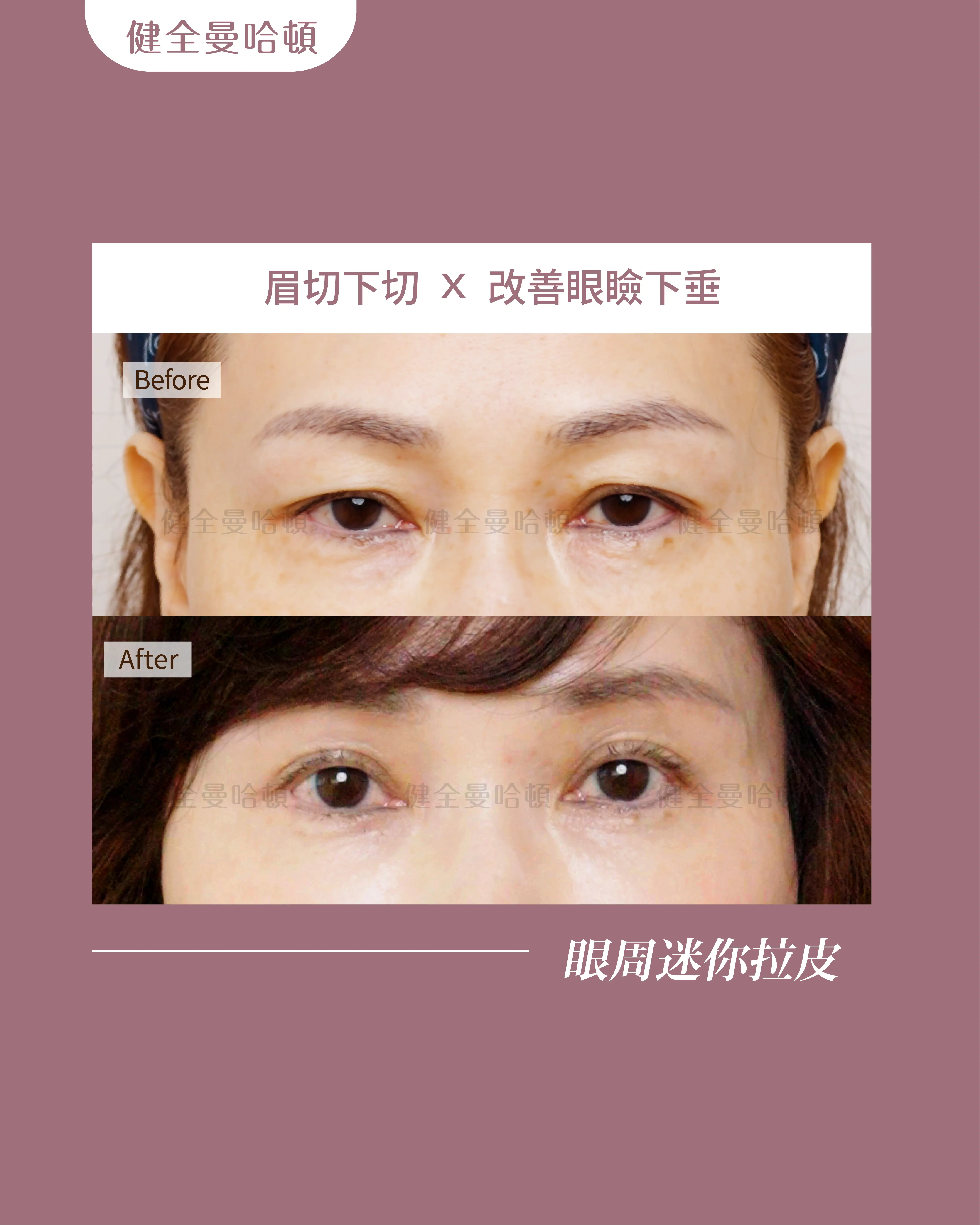 圖 工作區域 1 複本 14