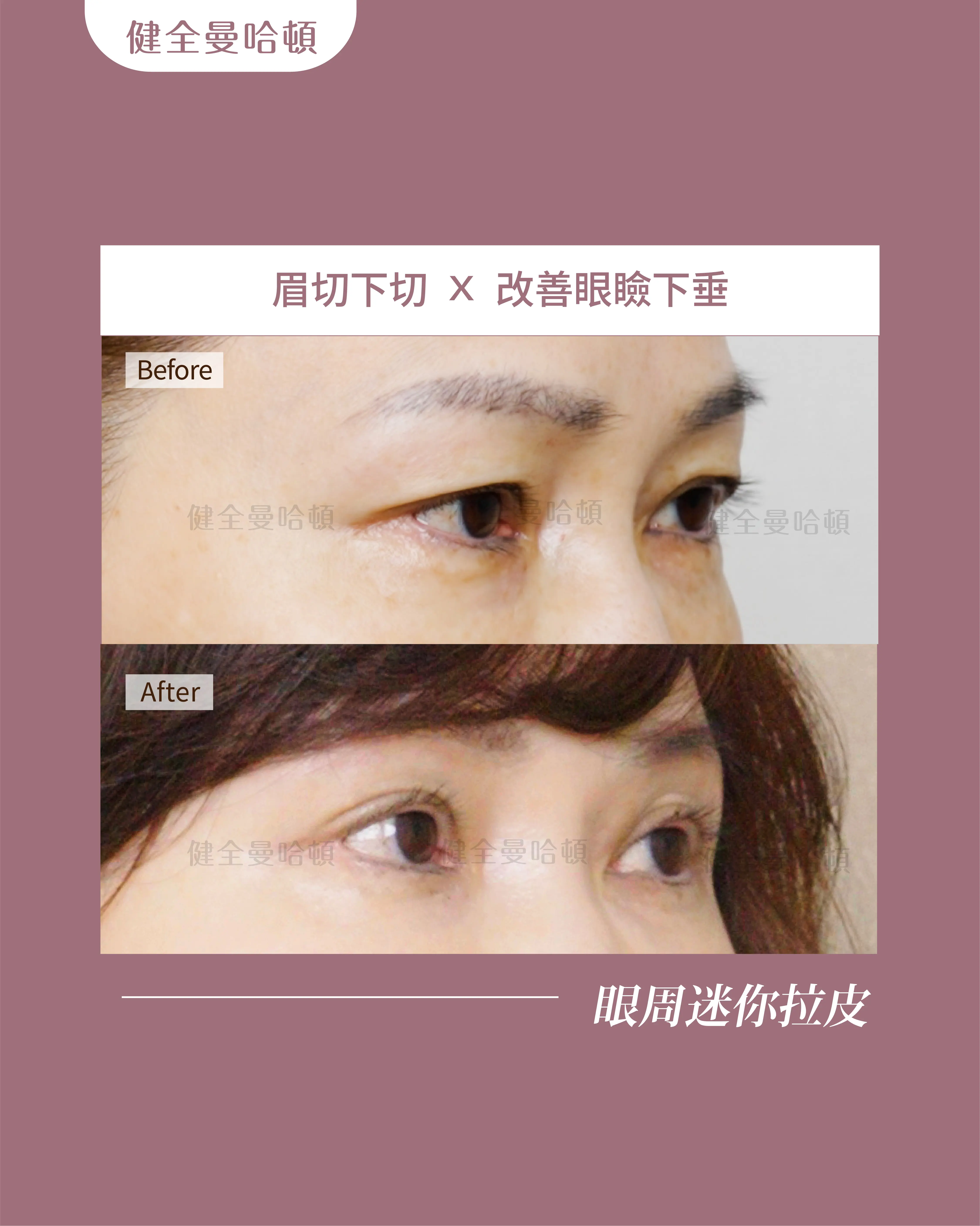 圖 工作區域 1 複本 15