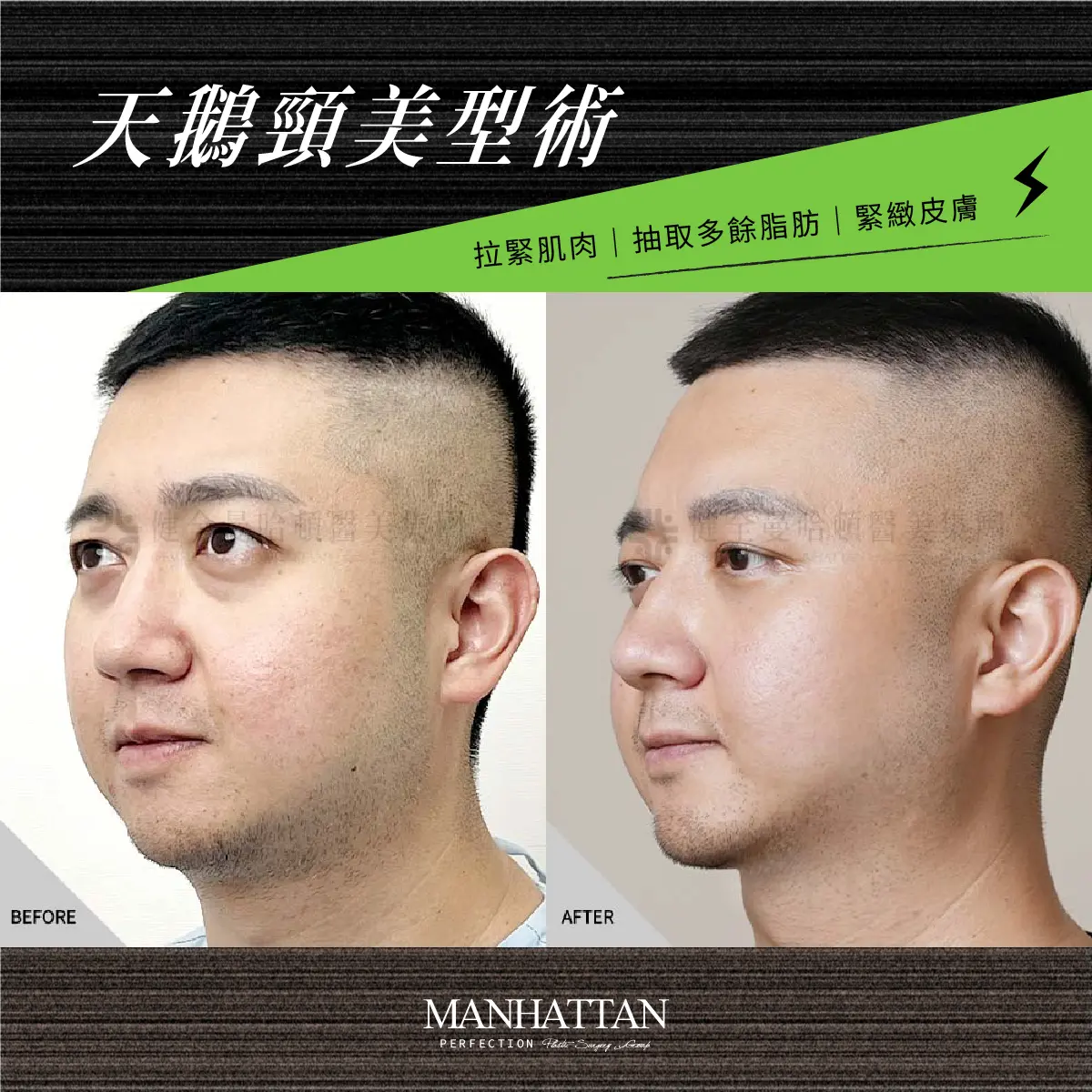 陳彥伯 天鵝頸 1200x1200 01