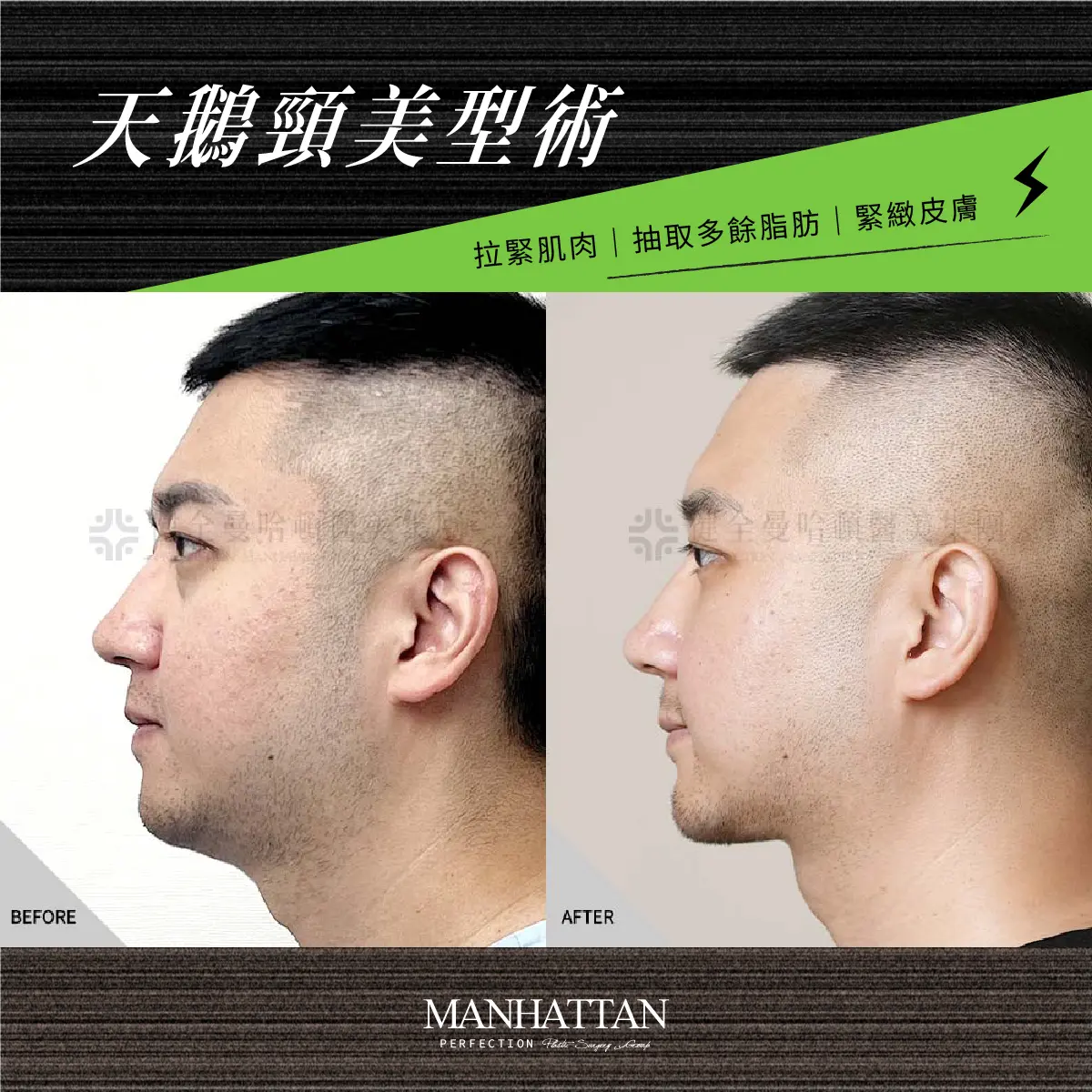 陳彥伯 天鵝頸 1200x1200 02
