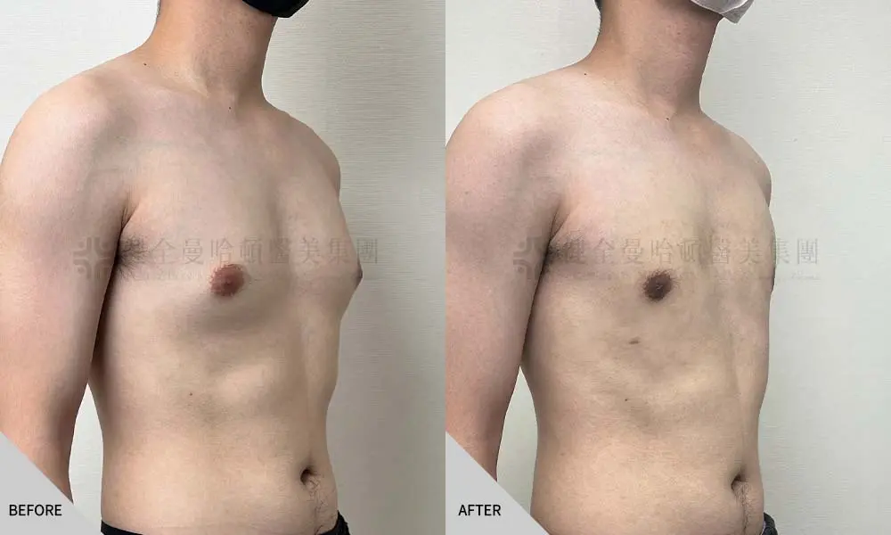 劉晉豪 男乳 02